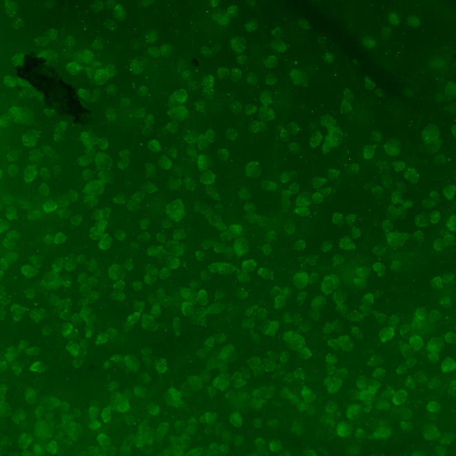 Example retinal image for RGC analysis